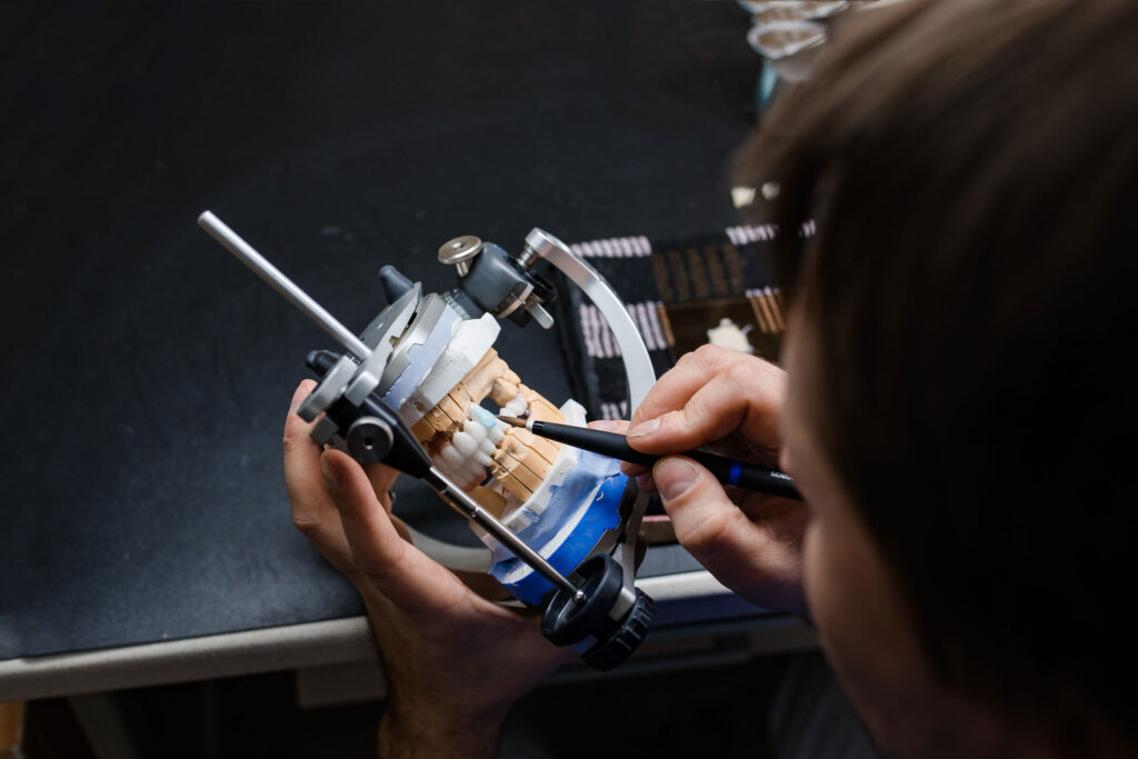 Zahntechniker bei der Feinarbeit an einem Kiefermodell im Artikulator – Schalow Dentaltechnik fertigt passgenaue klassische Restaurationen und komplexe Implantatversorgungen mit handwerklicher Präzision für Zahnarztpraxen.